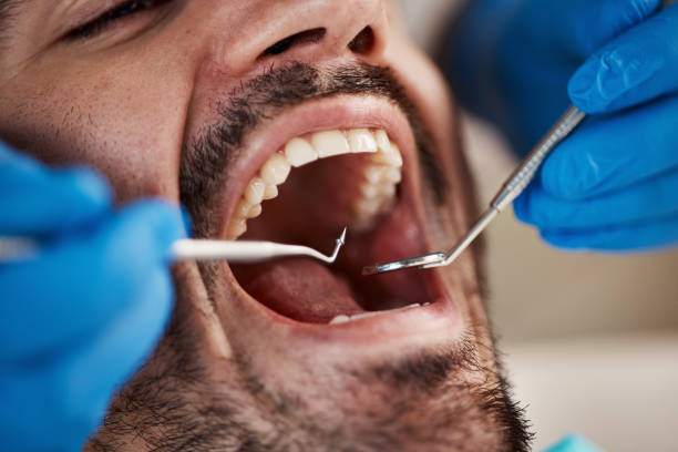 Best Sedation Dentistry  in Nitro, WV